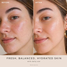 Spray de agua de rosas para la cara, fabricado en Estados Unidos con ingredientes hidratantes naturales y orgánicos para una piel brillante, sin alcoh