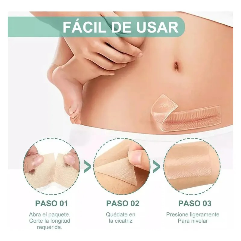 Hojas Silicona Scar Patch 4cm 300cm Cicatrices