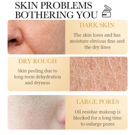 Retinol Face Cream with Hyaluronic Acid, Collagen & Vitamins B5, C, E – Anti Wrinkle & Anti Ageing Moisturiser – Dark Spot Corrector Facial Care – Hydrating Night Cream for Women & Men 50g