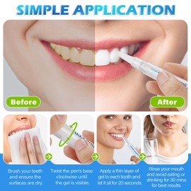 Teeth Whitening Pen 4 Pcs, Teeth Whitening Pen Gel with Professionally Formulated, Teeth Whitening Essence Pen, Low Sensitivity, Travel-Friendly - Fresh Mint Flavor