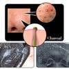 SHILLS Blackhead Remover,Pore Control, Skin Cleansing, Purifying Bamboo Charcoal, Peel