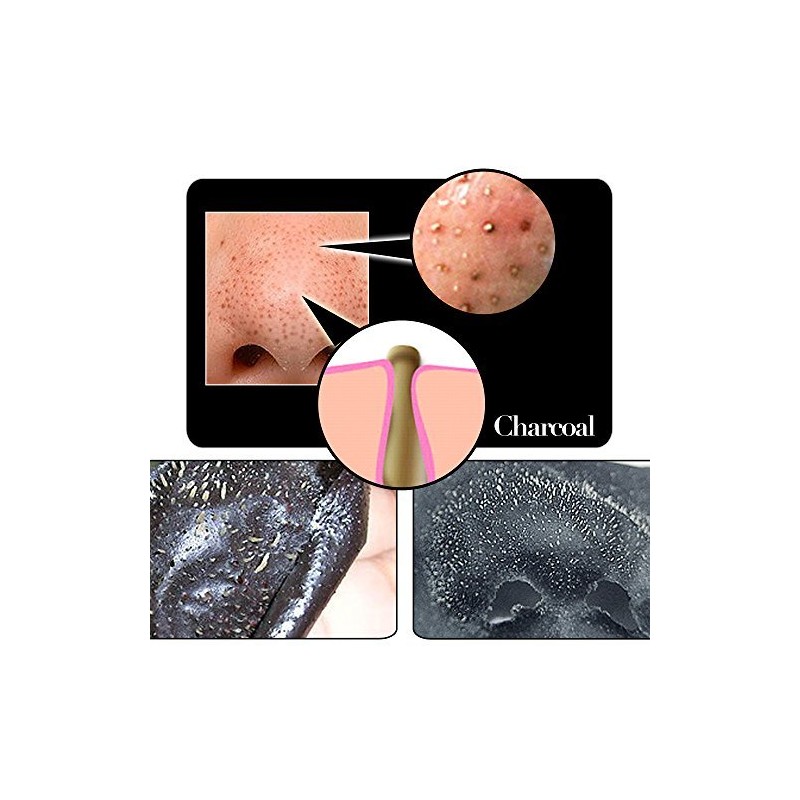 SHILLS Blackhead Remover,Pore Control, Skin Cleansing, Purifying Bamboo Charcoal, Peel