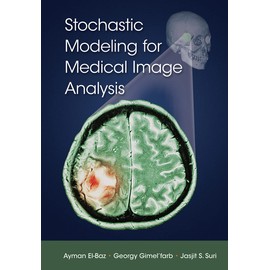 Stochastic Modeling for Medical Image Analysis