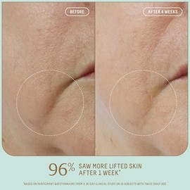 Biossance Squalane + Firm & Lift Dual Serum - Suero facial para piel madura - Levanta e hidrata - Reduce las arrugas - Ácido hialurónico, escualano, ectoína, gravetye gigante y bisabolol - 1.0 fl oz