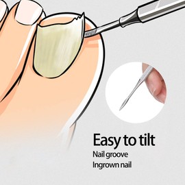 Herramientas de Corrección de Uñas Encarnadas, 3 Piezas Herramientas Profesionales de Corrección de Uñas Encarnadas Almohadilla de Uñas Levantador de Uñas Encarnadas Kit de Lima de Doble Extremo Resue