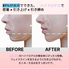 FACELINEMASKE Small Face Mask, Chin Removal, Small Face Belt, Double Chin Relief, Face Slack Lifting, Face Fat Suction Fixing Band, Face Wrinkle Removal, Sagging Improvement Goods, Lift-Up, Faceline