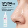 Super Melting Sebum Softener, Blackhead Remover Liquid for Deep Pore