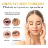 Crema De Péptidos Firmes Para El Endurecimiento De Ojos X,