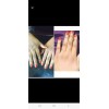 Super strong Peeling oil Whitening oil Lightening Brightening,da