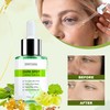 Dark Spots Serum Oil, Face Serum Oil, Light Skin Dark