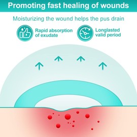 Dimora Hydrocolloid Dressing 4" x 4" for Wound Care, 10 Pcs Large Patch Bandages with Self-Adhesive for Bedsore, Burn, Blister, Acne Care, Super Absorbent for Fast Healing