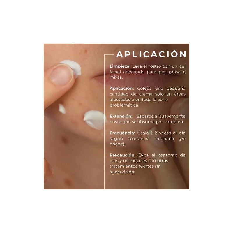Crema Anti Acné Mc Life Control De Grasa Reduce Manchas