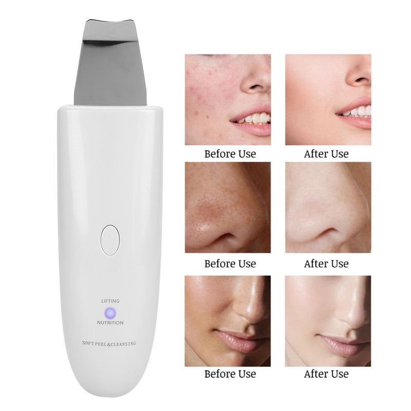 Household Ultrasonic Skin Scrubber Blackhead Removal Face Pore Cleanser InstrumentWhite