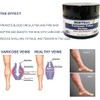 Vein Stretch Cream, Leg Vein Stretch Cream, Spider Vein Repair