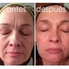 Galvanica Facial Lifting. 3 Distintos Cabezales Biomicro Spa