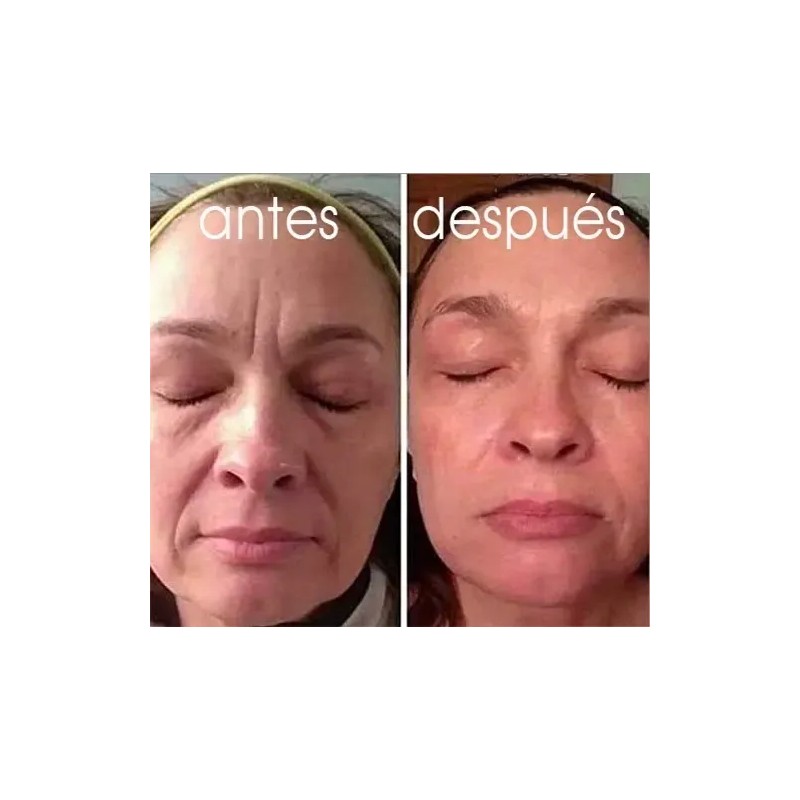 Galvanica Facial Lifting. 3 Distintos Cabezales Biomicro Spa