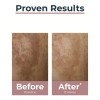 Eucerin Anti-pigment Dual Serum 30 Ml Importación Europea