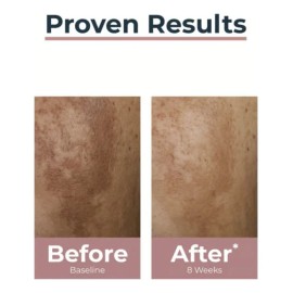 Eucerin Anti-pigment Dual Serum 30 Ml Importación Europea