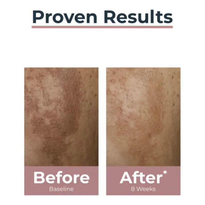 Eucerin Anti-pigment Dual Serum 30 Ml Importación Europea