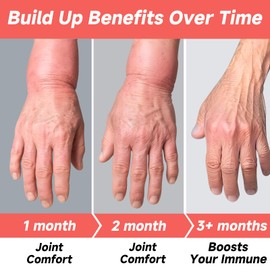 Uric Acid Flush,Tart Cherry with Celery Extract & Turmeric,Uric Acid Cleanse & Detox for Muscle, Joints Support & Kidney Cleanser,20 Capsules Uric Acid Support Supplement