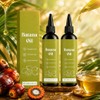 Batana Oil, 2PCS Aceite De Batana, Bata-na Hair Oil, Aceite