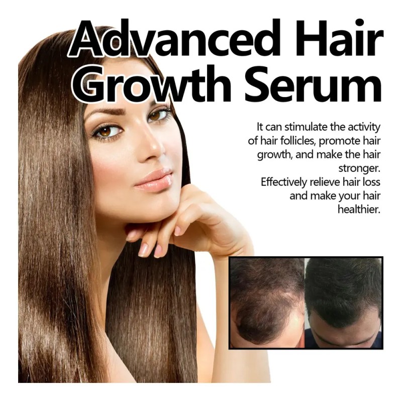 Azs Esencia Avanzada Crecimiento Capilar 30ml .