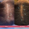 Laboratories Spectral Csf Tratamiento Regeneración Cabello Mujeres Suero Biotina Crecimiento
