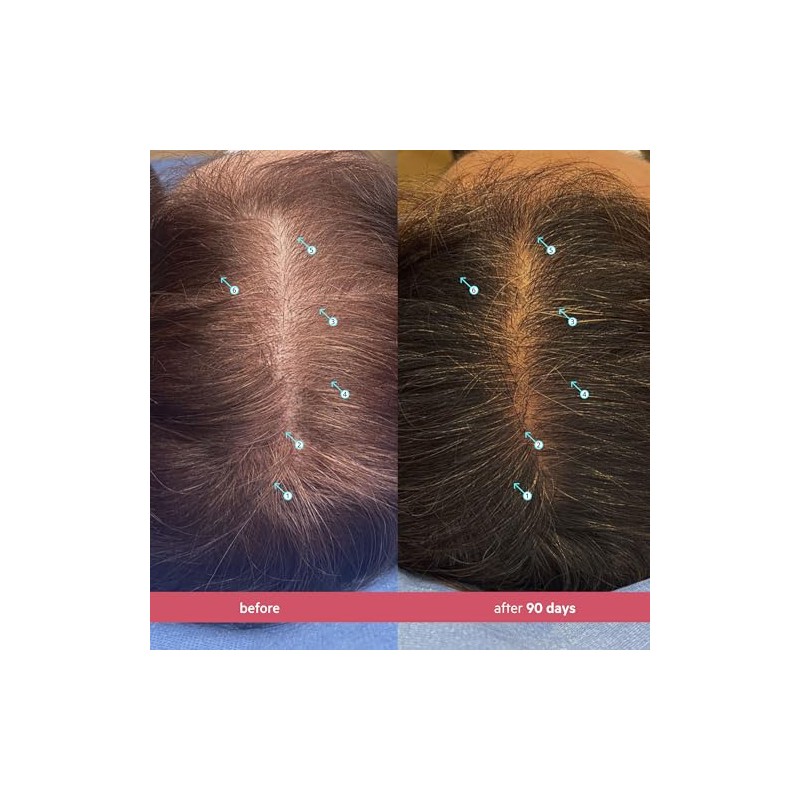 Laboratories Spectral Csf Tratamiento Regeneración Cabello Mujeres Suero Biotina Crecimiento