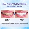 [+1$ get 3 pcs] Hotluck Toothpaste Oral Health Management, Fresh