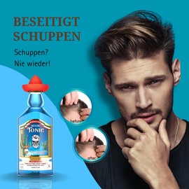 BANDIDO Haarwasser Anti-Schuppen 250 ml – Haarwasser Männer gegen Haarausfall – Haare Tonikum – Kopfhaut bei Juckreiz – Beruhigendes Kopfhaut Tonikum für empfindliche Kopfhaut.