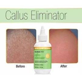 BCL Spa Eliminador De Callos Pedicure Profesional Spa 118 Ml Naranja