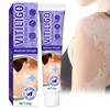 maxboss Vitiligo Treatment, Natural Vitiligo Cream, Effective Improve Skin Pigmentation