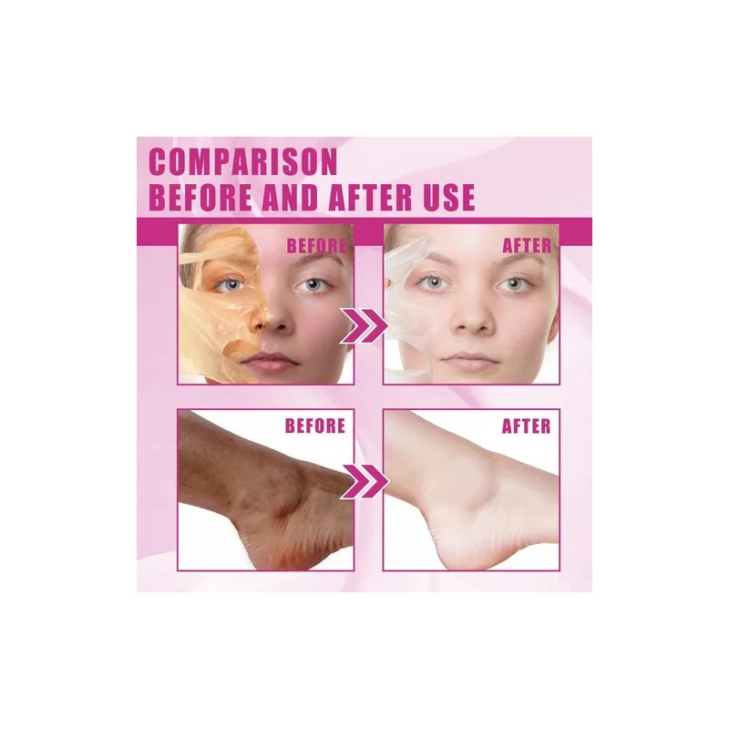 _ Aceite Exfoliante Amarillo Para Pelar, Aceite Exfoliante