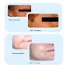Crema Cicatrizante Dermatix Ultra Todo Tipo Piel 15g