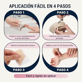 Over Lu DermaSilk™ | Cinta de Silicona para Cicatrices – Parches de Silicona Reutilizables para Cicatrices Quirúrgicas, Cesárea, Acné y Estrías – Grad