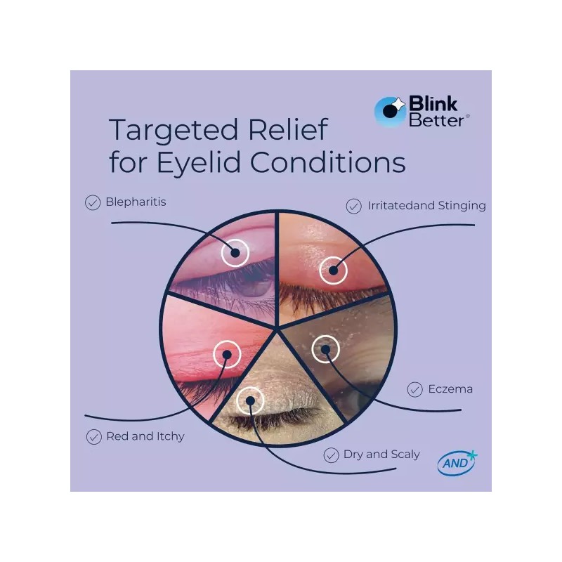 BlinkBetter 건조하고 가려우며 민감한 눈꺼풀을 위한 블링크베터 연고 - 시어