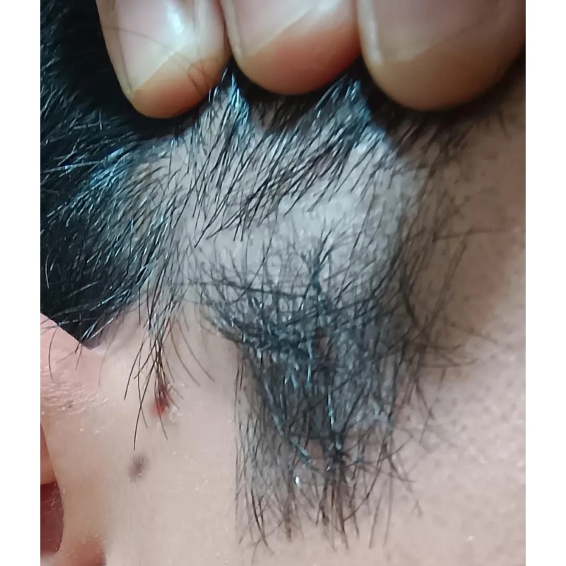 Shampo Sólido Anticaspa - Psoriasis Cinnafix
