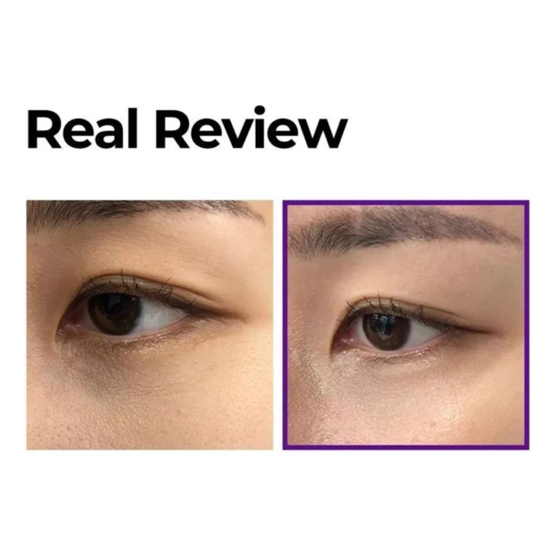 Some By Mi Retinol Intense Advanced Triple Action Eye Cream