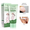 Stretch Marks Cream Prevent and Reduce Stretch Marks Pregnancy Safe