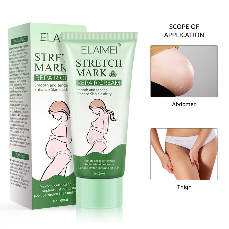 Stretch Marks Cream Prevent and Reduce Stretch Marks Pregnancy Safe