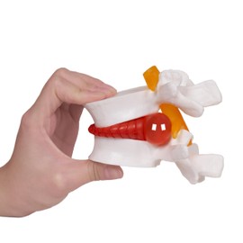 NLShan NLShan Human Anatomical Lumbar Disc Herniation Model, Portable Herniated Lumbar Vertebrae Disc, 1.5 Times Life Size Lumbar Spine Model for Teaching, Learning and Demonstrating