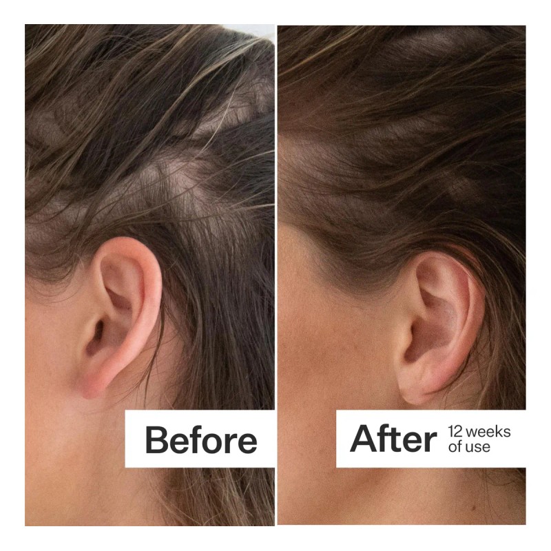 Act+ Acre Cápsulas Para Cabello Grueso Y Fuerte 60 N/a