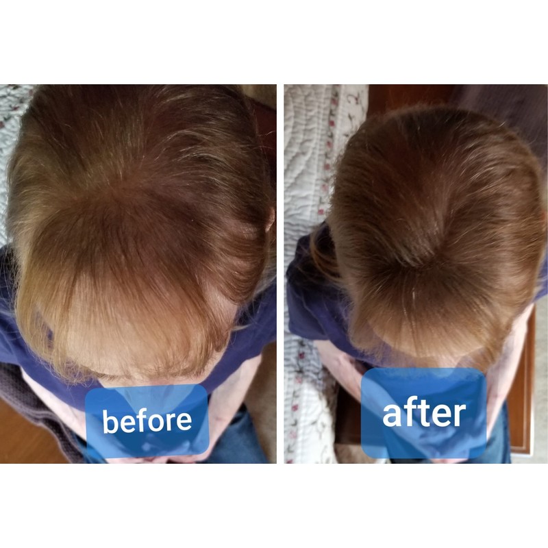 Caboki Hair Concealer (All-Natural Hair Building Fibers) Travel Size (Light