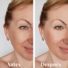 Kit Antiedad Y Rejuvenecedor Lilo Skincare Vitamina E