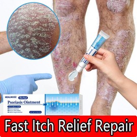 TikTok Viral Psoriasis & Fungus Cream 20g – Extra Strength Natural Formula, Stops Itching Fast, Repairs Dry Skin, Soothes Psoriasis, Ringworm & Jock Itch