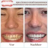 SPOKKI 4 Pairs of Fake Teeth, False Teeth Veneers, Cosmetic