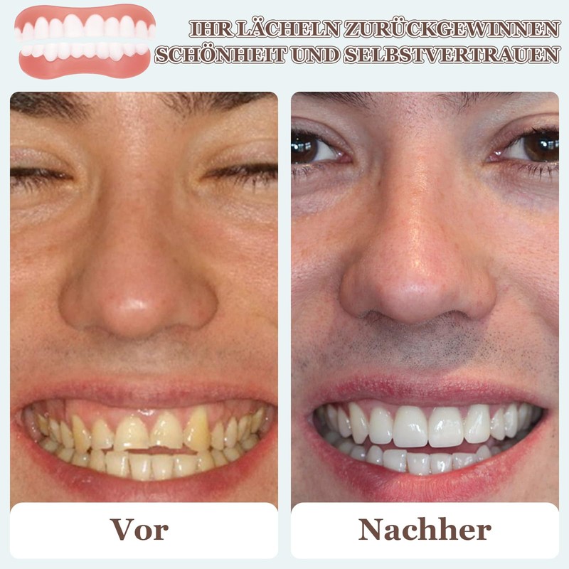 SPOKKI 4 Pairs of Fake Teeth, False Teeth Veneers, Cosmetic