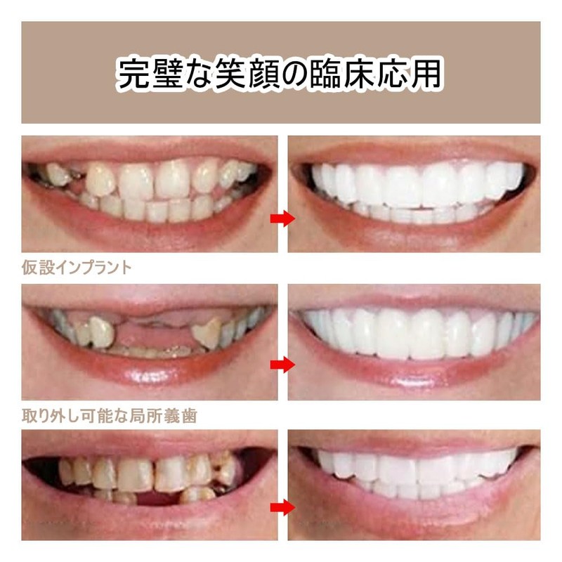 Instant Dentures Prosthetic Teeth Beauty False Teeth Upper+Lower Teeth Instant