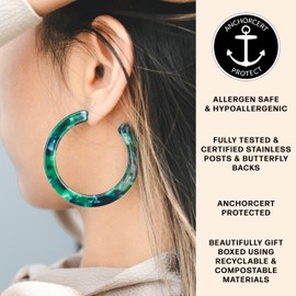 Green Tortoise Shell Hypoallergenic Large Hoop Earrings | Allergen Safe Earrings, Bold Statement Fashionable Big Hoop, Green Earrings, Dark Green, Acetate, Acrylic, Resin, Gift, Gift for Her