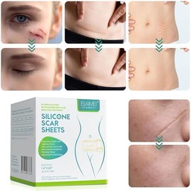 Cinta de silicona para eliminar cicatrices (rollo de 4cm x 1.5 m), eliminación de cicatrices de grado médico profesional, reutilizable, elimina cicatrices antiguas y nuevas, hojas de eliminación para cesárea, cirugía, quemaduras, queloides, acné